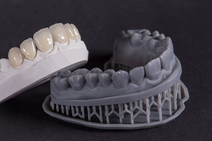 Impresión de modelos dentales 3D